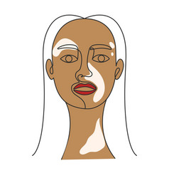 Portrait Of A Woman With Vitiligo Line Art