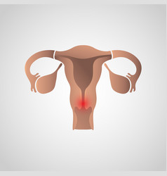 Cervical Cancer Icon Design Infographic Health