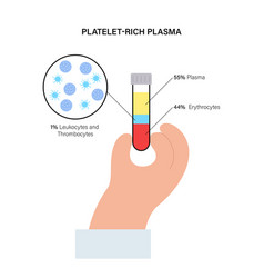 Platelet Rich Plasma Concept