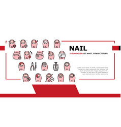 Ingrown Nail Disease Landing Header