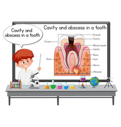 Young Scientist Explaining Cavity And Abscess