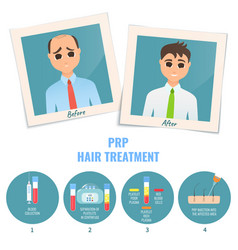 Man Before And After Prp Treatment