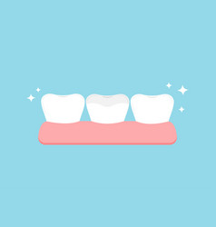 Teeth With Ceramic Overlay In Gym Dental Icon