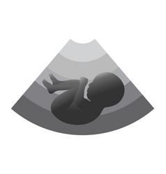 Fetal Ultrasound