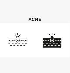 Deep Dirty Pore Skin Problem Symbol Collection