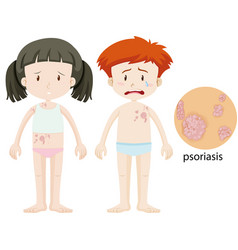 Boy And Girl With Psoriasis