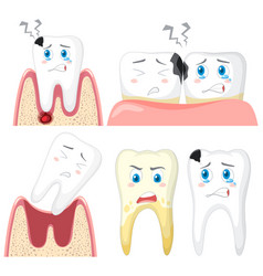 Set Of Teeth Decay On White Background