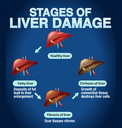 Stages Of Liver Damage Infographic