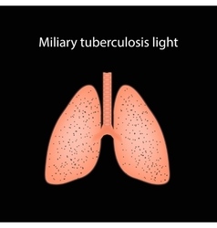 Military Tuberculosis