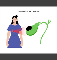 Gallbladder Cancer Anatomy