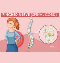 Woman With Pinched Nerve On Poster