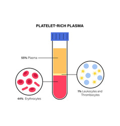 Platelet Rich Plasma Concept