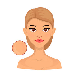 Woman Different Types Of Normal Skin Enlarged