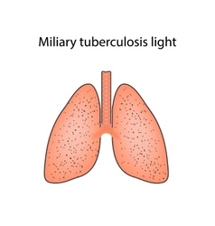 Military Tuberculosis