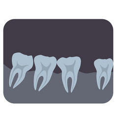 Intraoral Radiograph Of Human Teeth And Gingiva