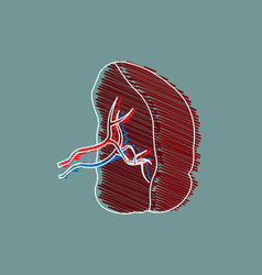 Medical Stylized Drawing Cartoon Of A Spleen