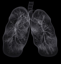 Covid-19 Computed Tomography Of The Lungs Ct Scan