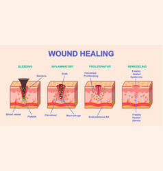 Wound Healing Process