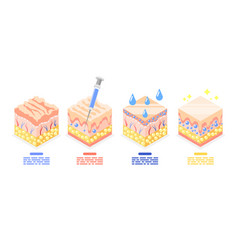 Skin Injections Isometric Set