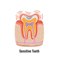 Dental Problem Poster