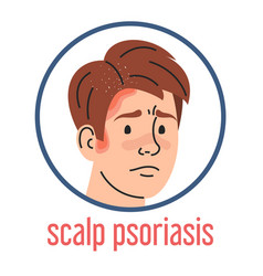 Scalp Psoriasis Sad Man With Red Itchy Spots