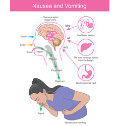 Nausea And Vomiting A Woman With Symptoms