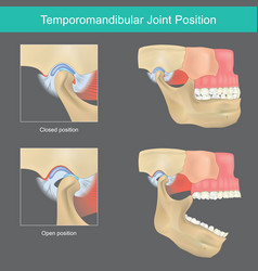 Temporomandibular Joint Position When Open Your