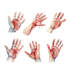 Human Hand With Wounds Isolated Bleeding Arm