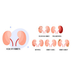 Kidneys Diseases Polycystic Kidney