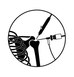 Shoulder Arthroscopy Poster