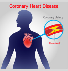 Coronary Heart Disease Logo Icon