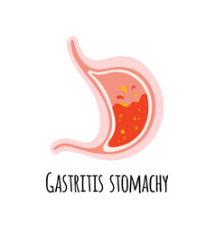 Stomach Of A Person With Gastritis