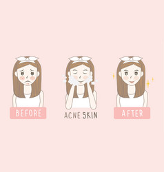 Woman Face Acne Before And After Skin Car