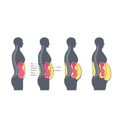 Visceral Fat Diagram