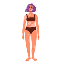 Women With Vitiligo In Swimsuit Body-positive