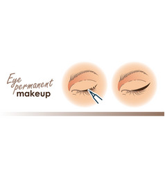 Eyeliner Procedure Eye Permanent