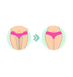 Female Fat Hips Woman Bottoms Flat Design