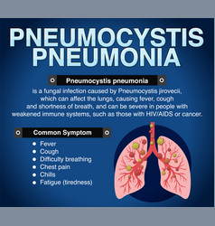 Informative Poster Of Pneumocystis Pneumonia