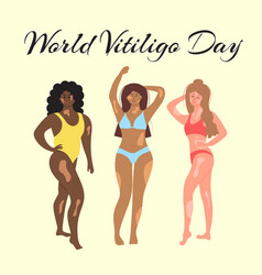 World Vitiligo Day Women With Vitiligo