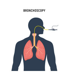 Bronchoscopy Respiratory System Emphysema