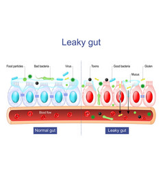 Leaky Gut Intestinal Permeability Barrier