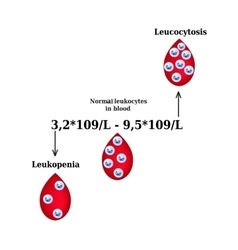 White Blood Cell Count Leukopenia Leukocytosis