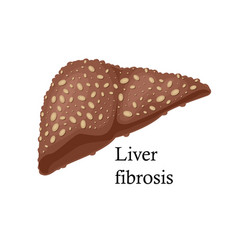 Fibrosis Liver On White