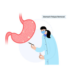 Stomach Polyp Removal