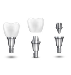 Tooth Implant