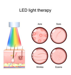 Led Light Therapy For Acne Treatment Scars And