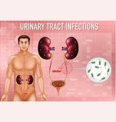 Informative Urinary Tract Infections