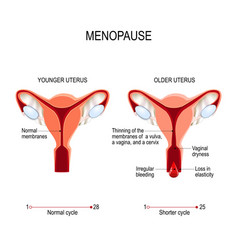 Menopause Or Climacteric Younger And Older Women