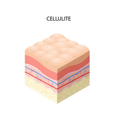 Skin With Cellulite Cross-section Human