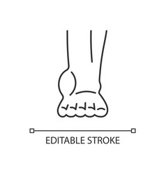 Ankle Inflammation Linear Icon